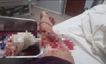 Una mujer embarazada expuso la “pésima atención” que recibió en el Hospital de La Toma