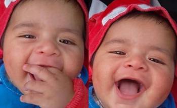 La carrera contra el tiempo de Samuel: necesita un casco ortopédico de $4,7 millones